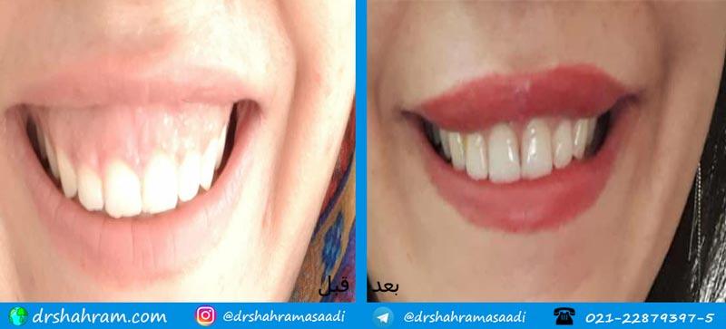 جراحی و درمان بیماریهای لثه