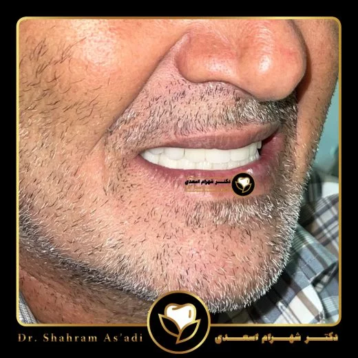 لبخند زیبا