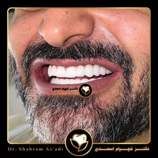 دندانپزشکی زیبایی