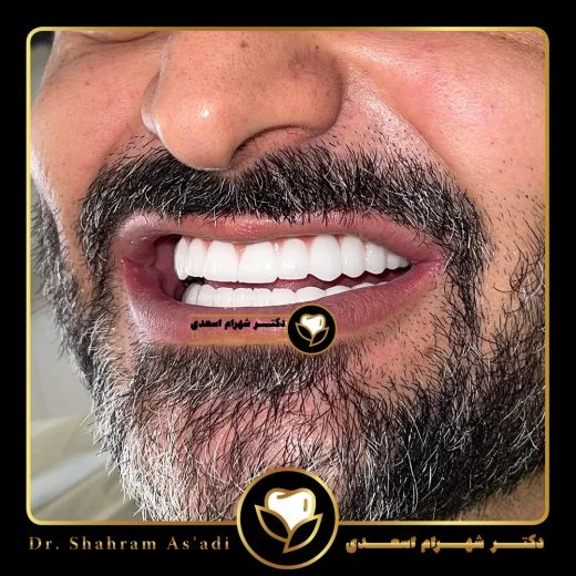 دندانپزشکی زیبایی