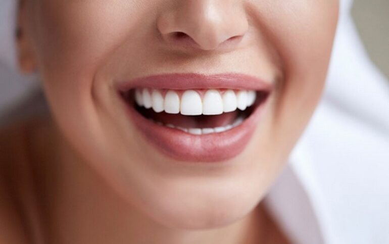 آشنایی با جدیدترین لمینت دندان