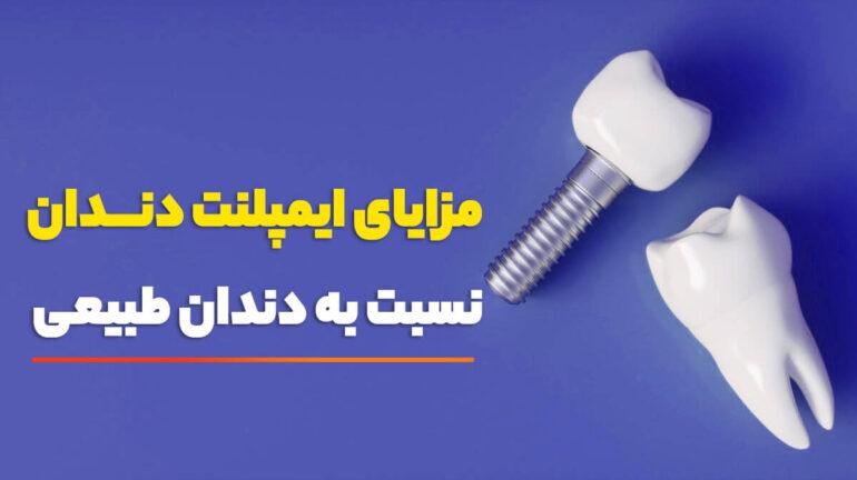 مزایای ایمپلنت دندان نسبت به دندان طبیعی