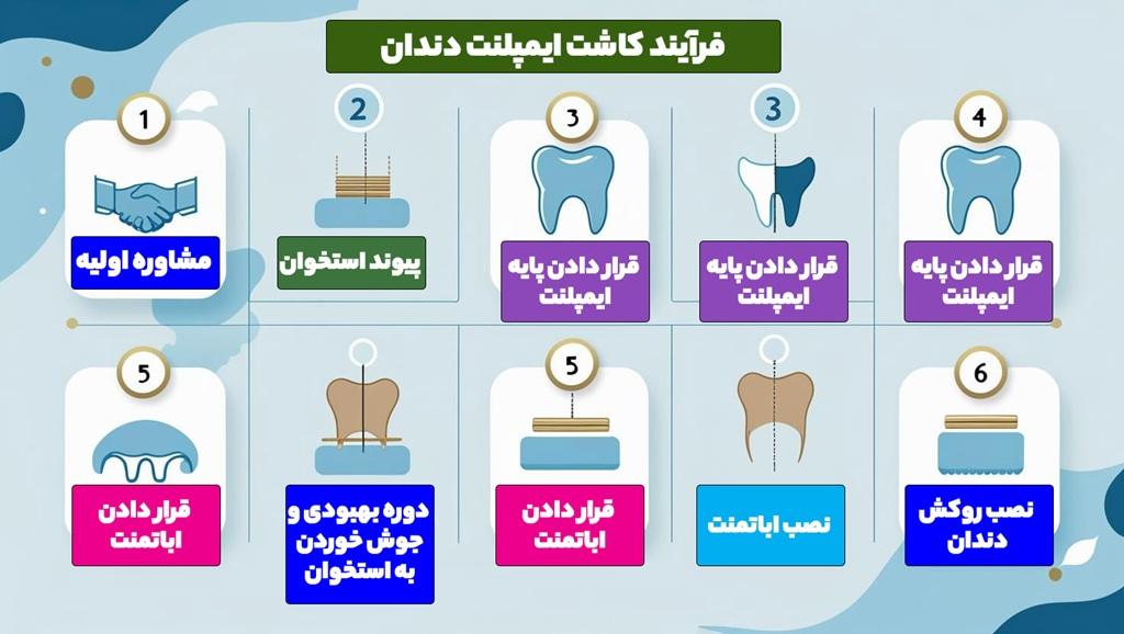 اینفوگرافی مراحل کاشت ایمپلنت دندان