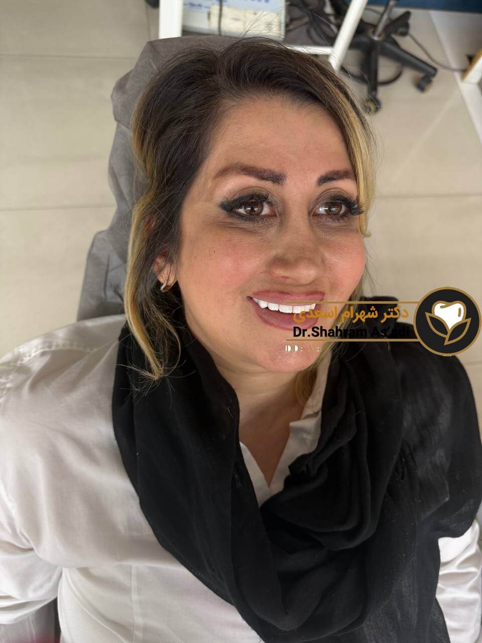 بهترین روش ایمپلنت دندان برای دیابتی ها