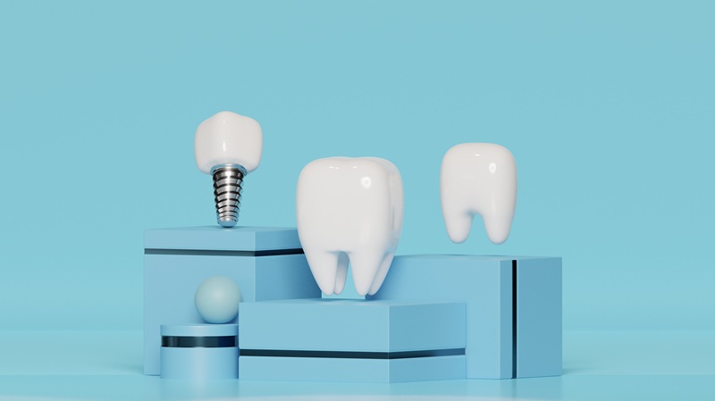 مزایای ایمپلنت دیجیتال؛ چرا کاشت دندان دیجیتال انتخاب هوشمندانه‌تری است؟